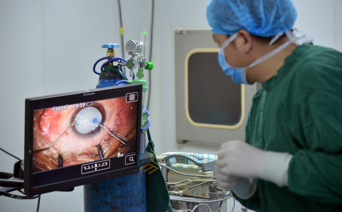 詳解白內(nèi)障到底會(huì)不會(huì)傳染？