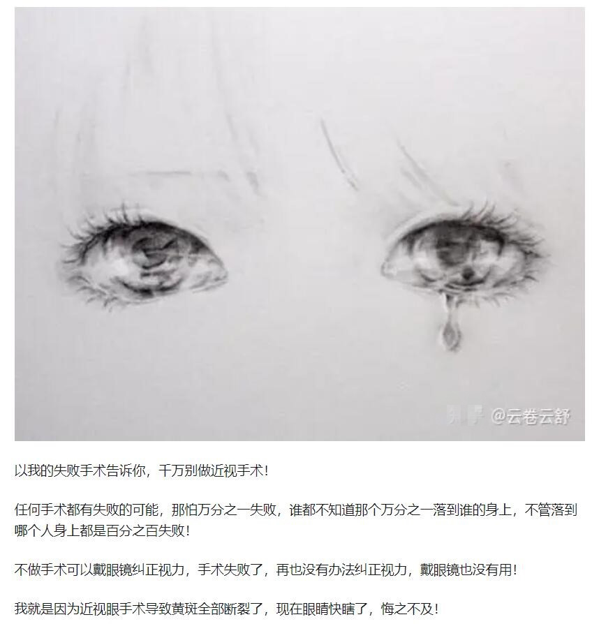 教你，怎樣去了解近視手術(shù)  